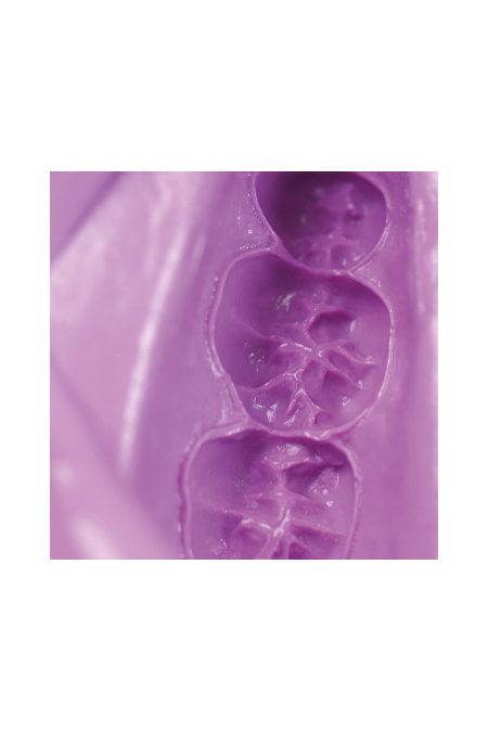 Alginat Hydrogum 5 Ča Dent 032